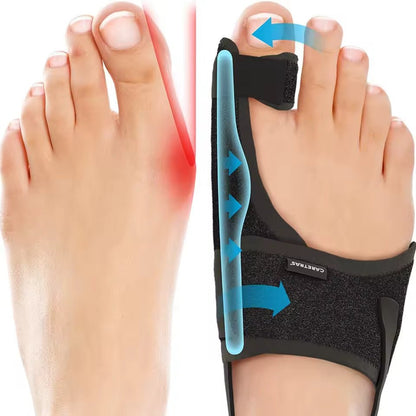 Adjustable Hallux Valgus Night Splint with Ergonomic Foot Support