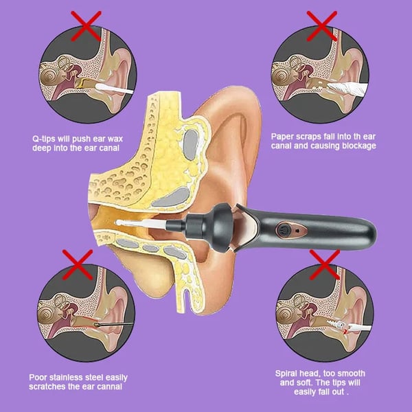 Gentle Ear Wax Removal Kit with Vacuum Suction and LED Light