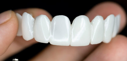 Snap-On Cosmetic Dental Veneers with Lightweight Reusable Design