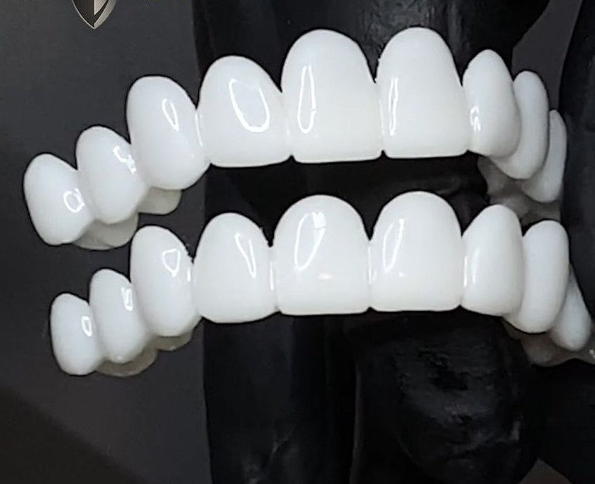 Snap-On Cosmetic Dental Veneers with Lightweight Reusable Design
